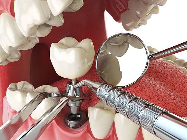 Best Broken Tooth Emergency  in Bellevue, WA